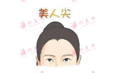 广州科发源美人尖种植费用是多少 专业植发机构 价格透明