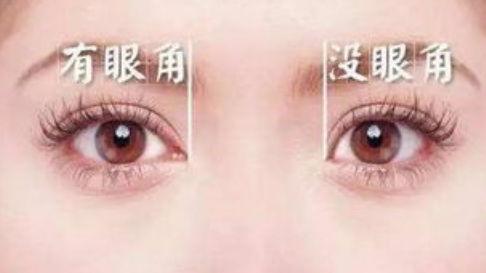 开眼角之后吃什么有助于恢复？开眼角后多久可以化妆？
