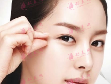 不适合做双眼皮的四类单眼皮女生！