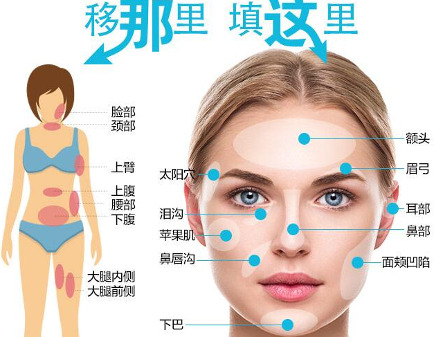 面部填充的方式|面部填充后为什么皮肤会下垂？
