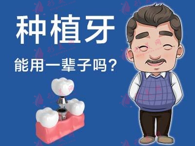 2022种植牙收费价格表公布！多少钱一颗？优点、适合人群全科普！