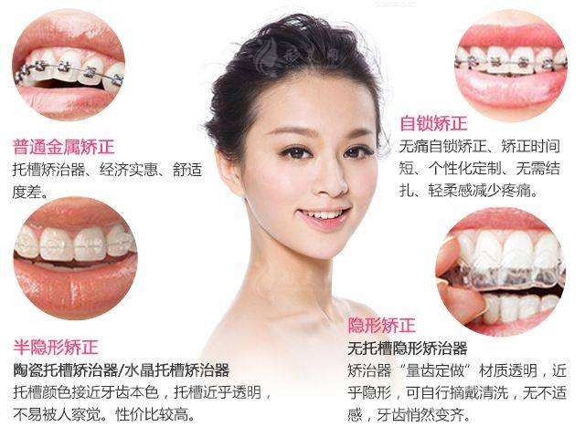 牙齿矫正