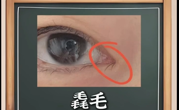 内眼角的毳毛是什么，上海爱尚丽格的专业建议