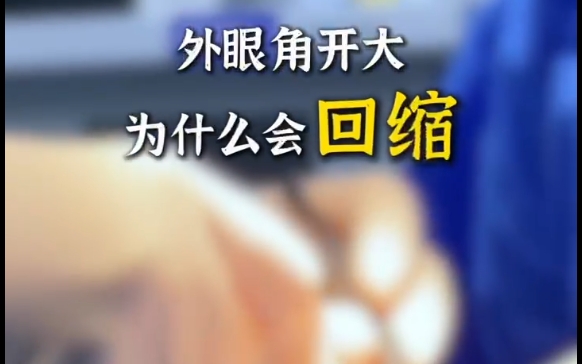 想知道为什么外眼角开大会回缩吗？杜园园医生来为您解答