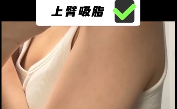 吸脂后上瘾的原因是什么？程辰医生为你解开疑团