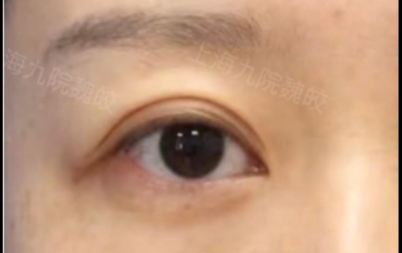 这种眼睛除了做提眉，其他什么也别做！