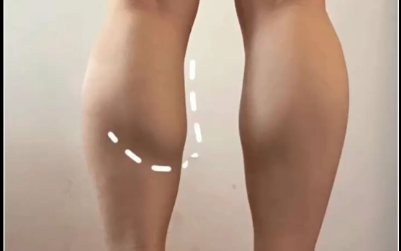 女生腿粗很难瘦？你真的了解自己的腿吗？