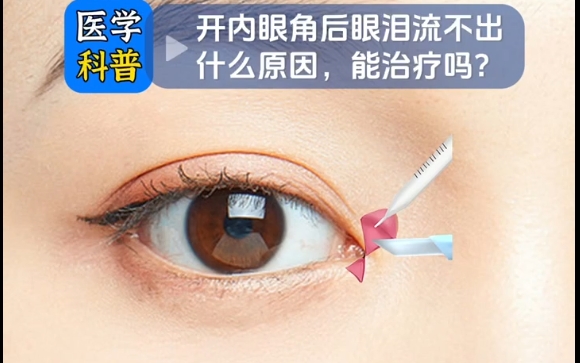 开内眼角后，眼泪流不出的原因及修复方法