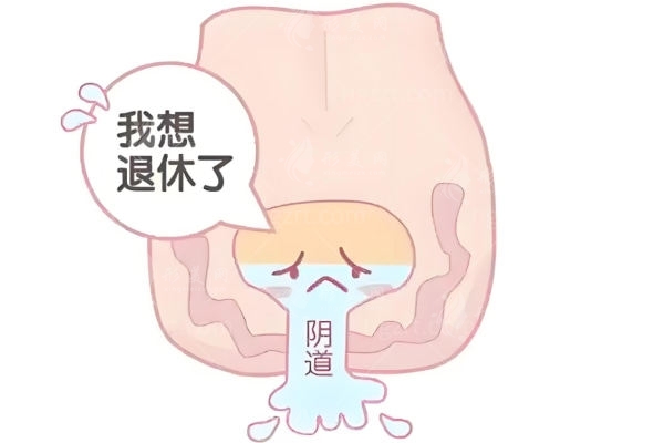 半岛热玛吉私密紧缩原理及与盆底肌仪/少女针区别