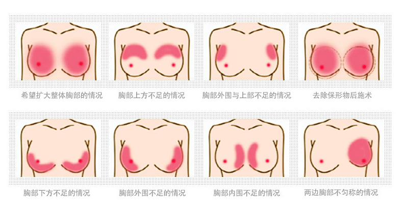 乳房发育正常吗轻微图片