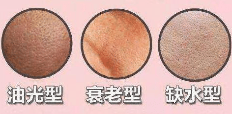 毛孔粗大的类型