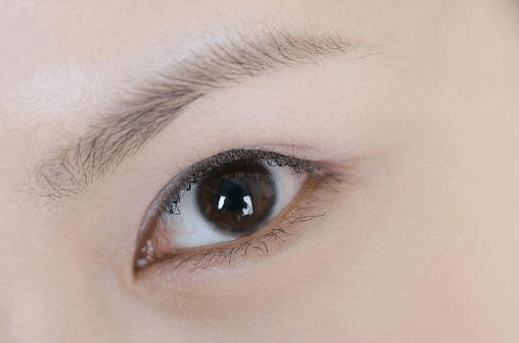激光洗眉
