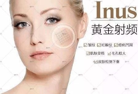 痘印可以通过黄金微针改善吗？