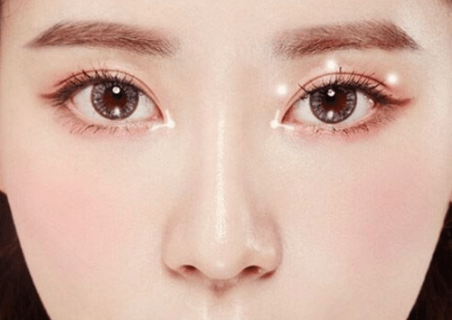 开眼角后千万不要做这件事！开眼角后的注意事项！