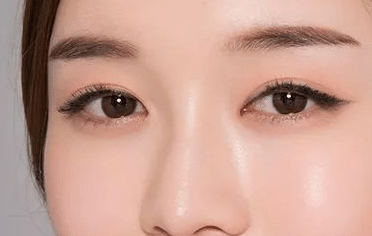 开眼角