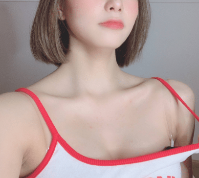 你听过这些奇葩整形手术吗？植入式胸罩|刮脚趾|氮气减肥法
