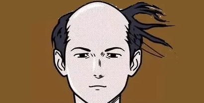 你是正常脱发吗？如何判断自己是正常脱发？