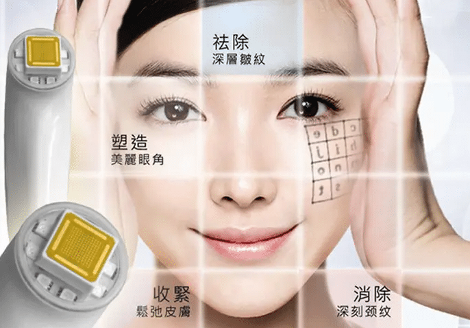 热玛吉除皱提升的原理|做完热玛吉会烫伤？