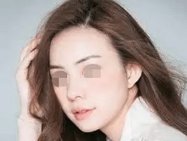 发际线种植手术能维持多久？术后护理应注意这几件事情！