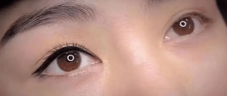 美瞳线