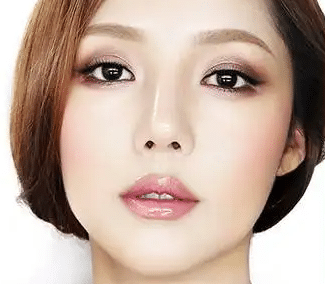 韩式三点双眼皮是什么？适合什么人做？