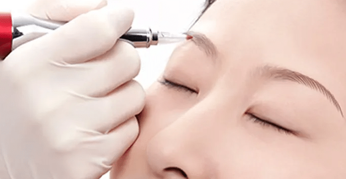 三种眉毛美容整形术！眉毛美容术前术后注意事项
