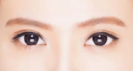 割完双眼皮可以化妆吗？多久可以化妆？