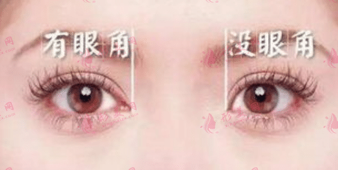 开眼角