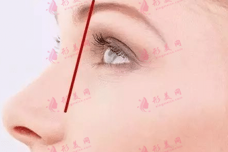 眼窝凹陷