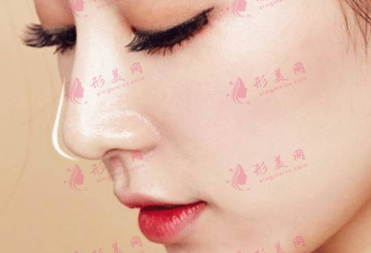 隆鼻