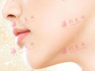 盘点七种常用瘦脸术|下颌角手术、注射瘦脸、面部吸脂