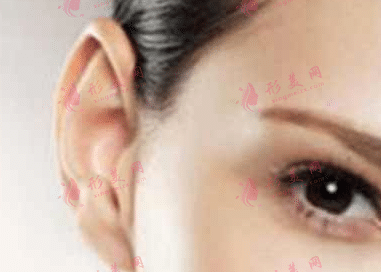耳部整形后耳朵痛是什么原因？要怎么解决？耳部整形护理