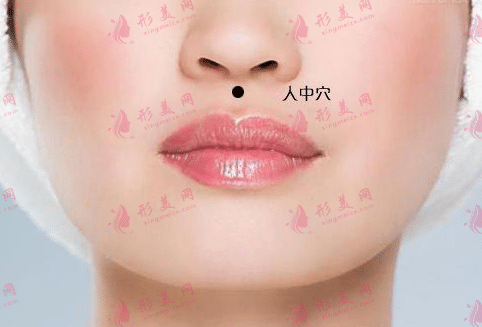 人中加深手术后几天后可以洗头？|术后护理