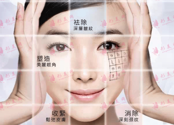热玛吉