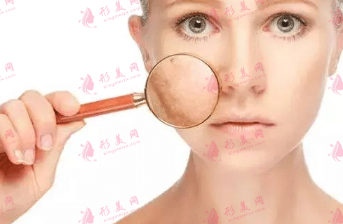 毛孔粗大