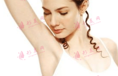 激光脱毛