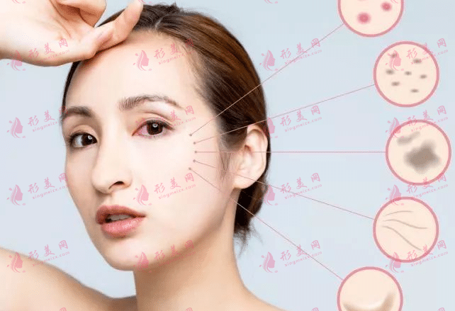 光子嫩肤不当会导致毁容吗？如果失败了该如何补救？