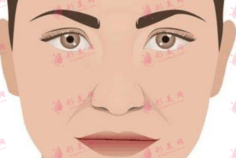 鼻基底和法令纹是一样的吗？它们之间的区别是什么？
