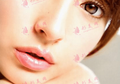 鼻翼缩小手术的恢复期是多久？对鼻子的损伤大不大？