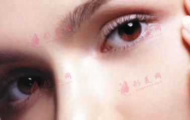 眼睑吸脂安全吗？效果怎么样？有什么优势？