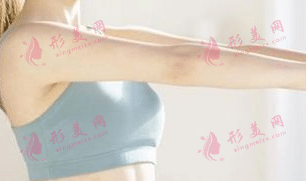 胳膊吸脂手术原理|做完胳膊吸脂后多久见效？