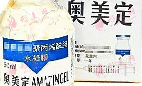 科普奥美定误区|注射奥美定后没有症状需要取出吗？