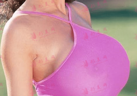 巨乳
