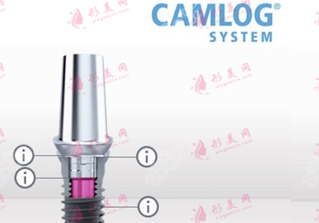 Camlog种植体