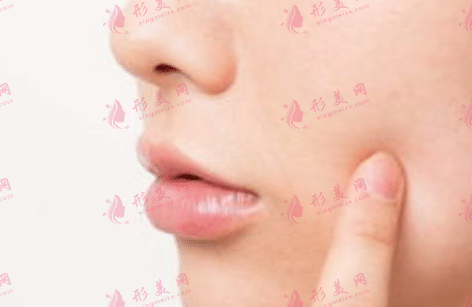 哪些禁忌不适合做自体脂肪移植？