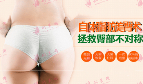 自体脂肪丰臀