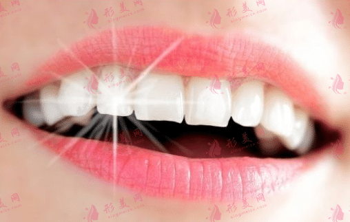 牙齿美白