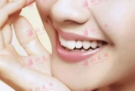 垫下巴后怎么护理？多久能完全恢复？