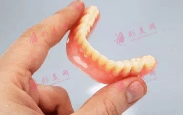 种植牙的优缺点|牙齿缺失的修复方式有哪些？