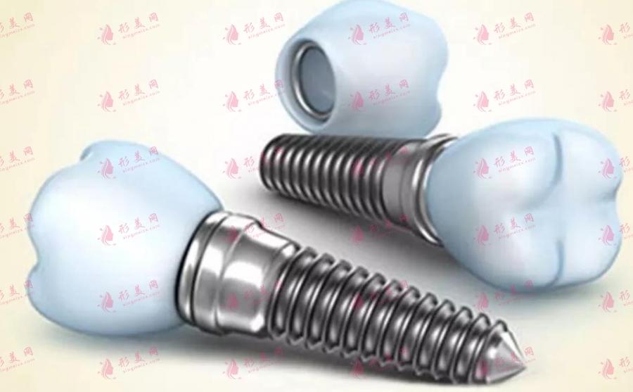 牙龈萎缩厉害可以种植牙齿吗？